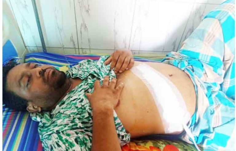 পারভীনের রিপোর্ট দেখে কাটা হলো পারভেজের পিত্তথলি