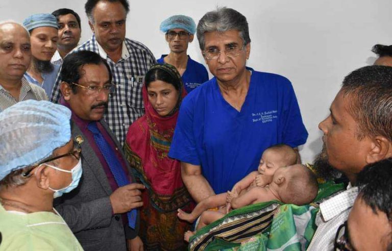 সফল অস্ত্রোপচারে আলাদা হলো জোড়া শিশু