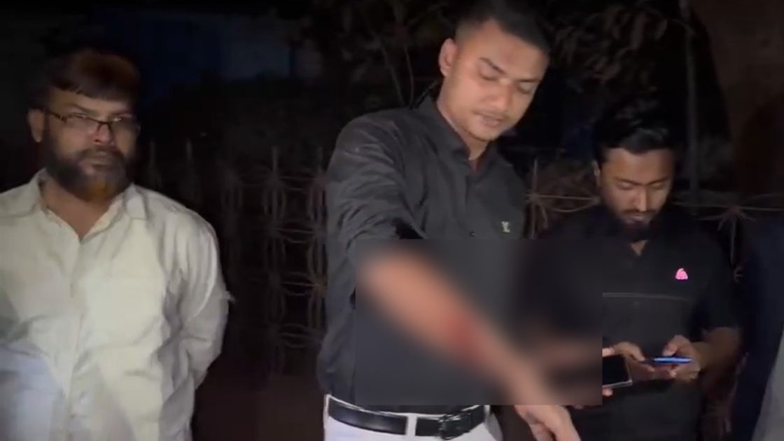 গাজীপুরে বৈষম্যবিরোধী ছাত্র আন্দোলনের এক কর্মীকে গুলি