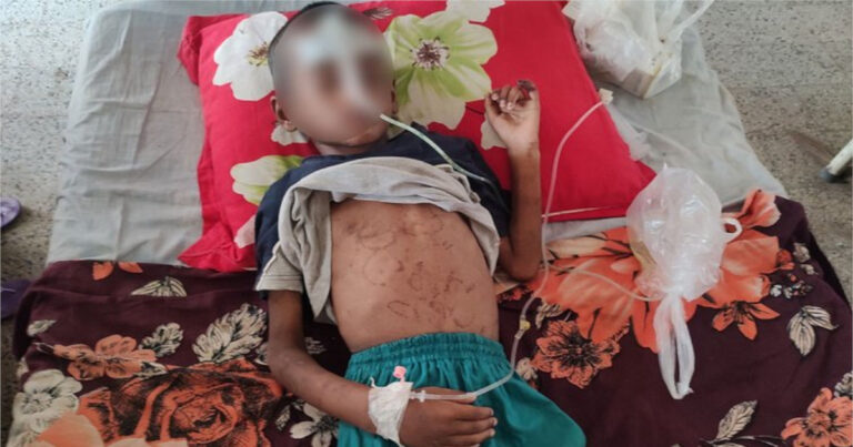 অপহরণের পর নির্যাতন, প্রতিবন্ধী বানিয়ে করানো হয় ভিক্ষা