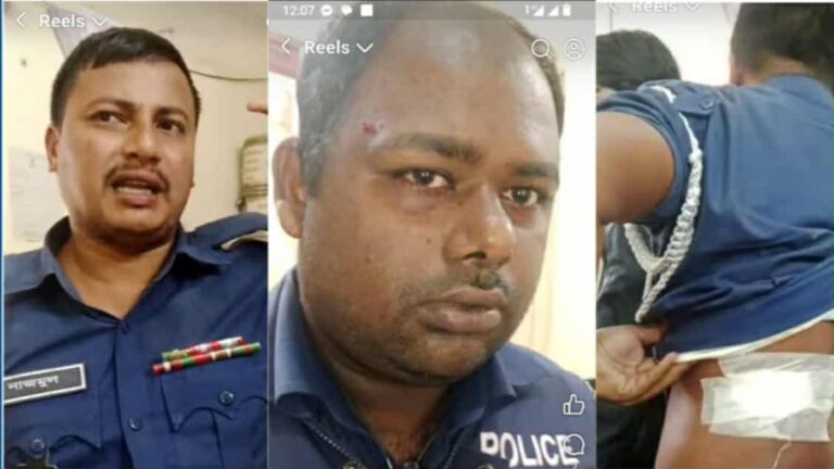 তদন্তে গিয়ে হামলার শিকার এসআইসহ তিন পুলিশ