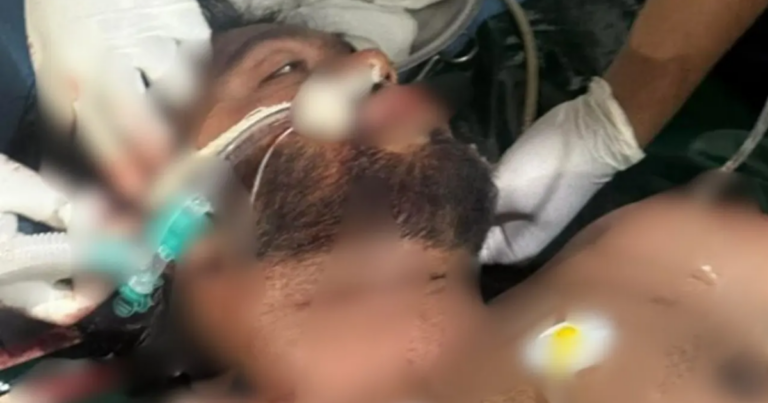 মাথায় বুলেট, ‘লাইফ সাপোর্টে’ হাদি: ঢামেক পরিচালক দপ্তর