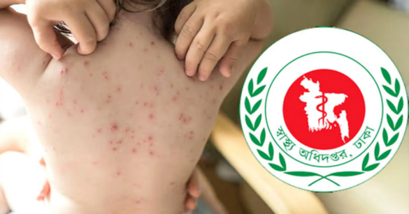 দেশে গত ২৪ ঘণ্টায় (শনিবার সকাল ৮টা থেকে রবিবার সকাল ৮টা পর্যন্ত) হাম উপসর্গ নিয়ে ৩ ও নিশ্চিত হামে এক শিশুর মৃত্যু হয়েছে।